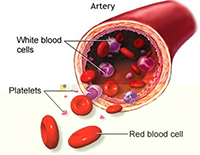 Platelet Rich Plasma